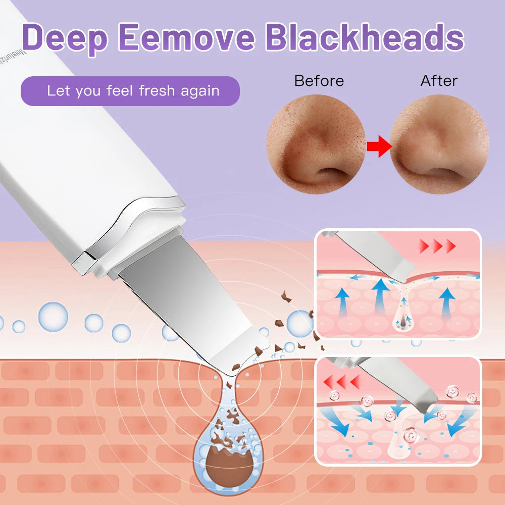 Ecobelle™︎ - Depurador y Exfoliante Facial Ultrasónico con vibración