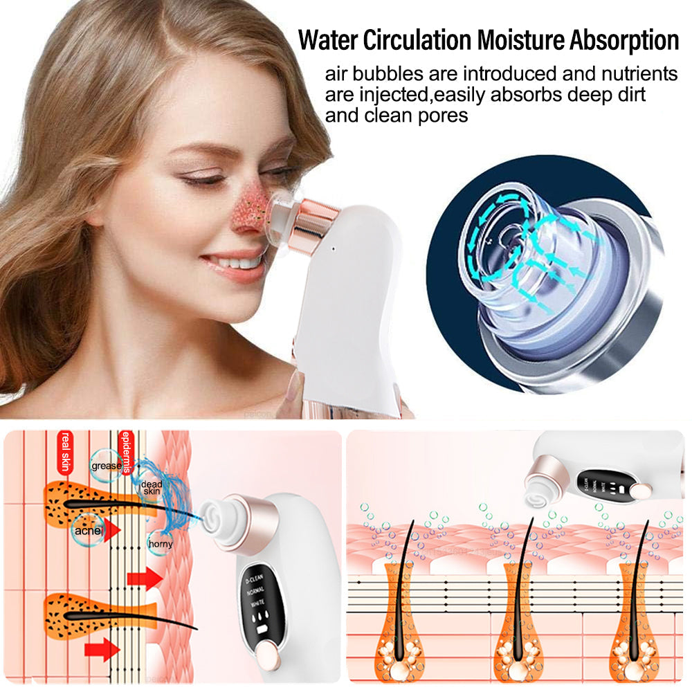 Ecobelle™︎ - Aspirador de Puntos Negros e Impurezas Faciales