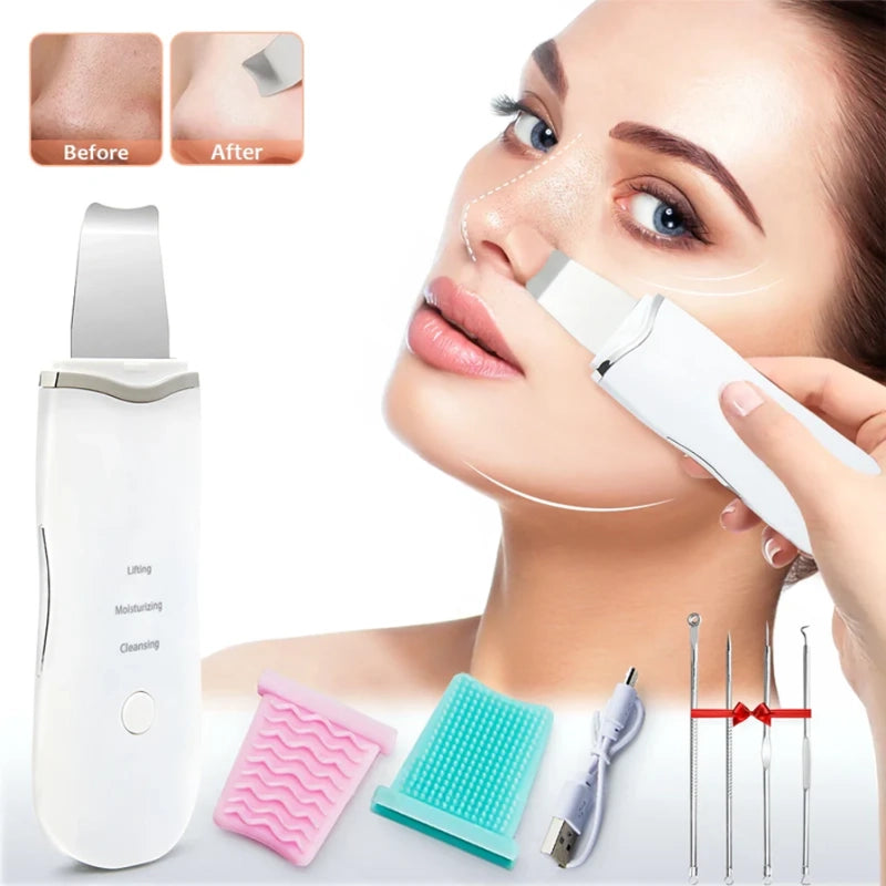 Ecobelle™︎ - Depurador y Exfoliante Facial Ultrasónico con vibración