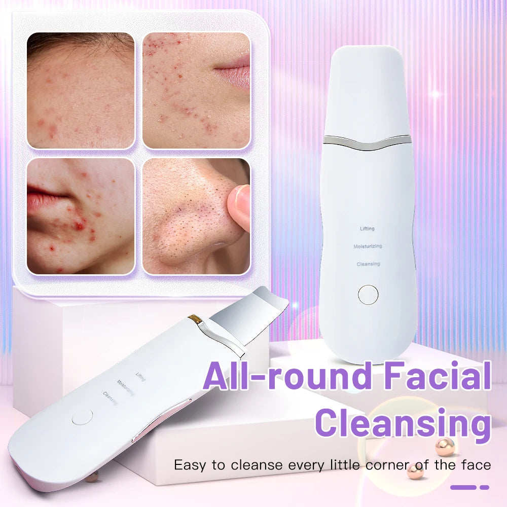 Ecobelle™︎ - Depurador y Exfoliante Facial Ultrasónico con vibración